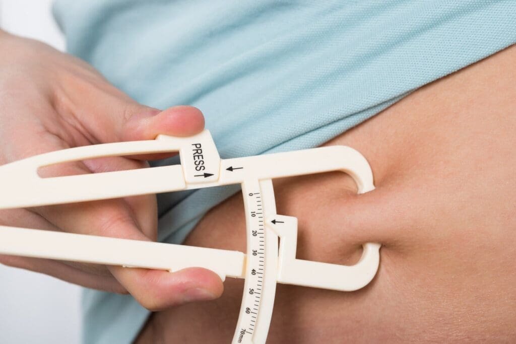 How to Prepare for and Recover From Bariatric Surgery